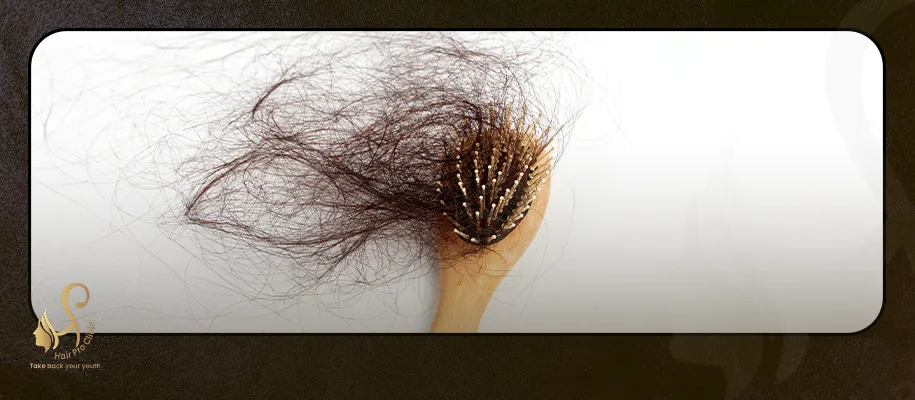 ما هو علاج الصلع الوراثي عند النساء