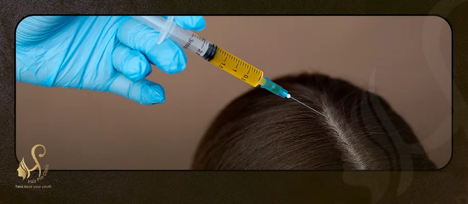 Hair Transplant Cost for Women in Egypt
