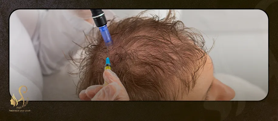 FUE Hair Transplant Cost in Egypt