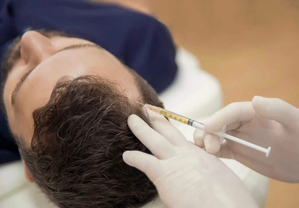 Which is better plasma or mesotherapy for hair