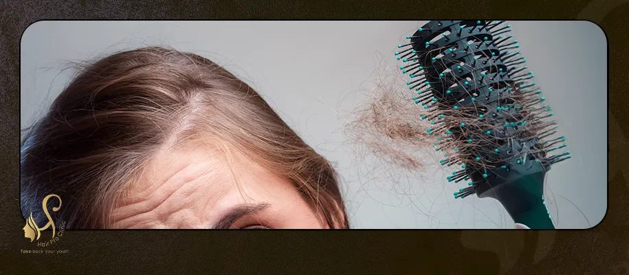 زراعة الشعر في مقدمة الرأس للنساء