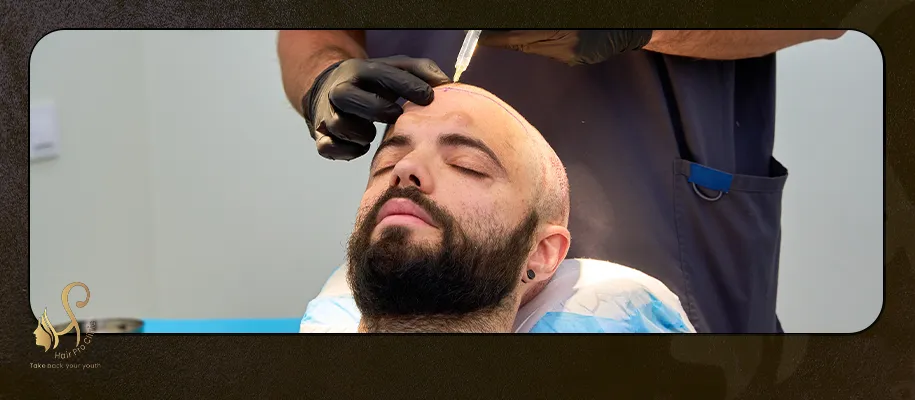 مركز زراعه الشعر بالتقسيط