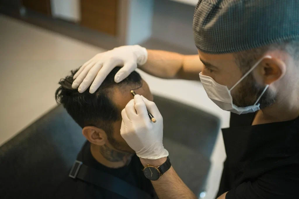 Best Hair Transplant Doctors in Egypt